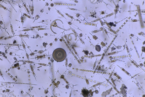 plancton microscope